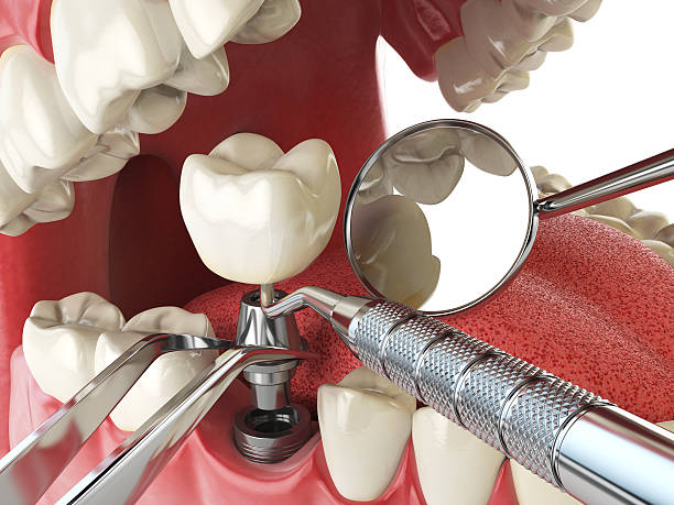 Best Emergency Treatment for Jaw Pain or Injury in Marine City, MI